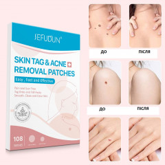 Патчі для видалення бородавок SEFUDUN Skin Tag Removal Patches 108 шт