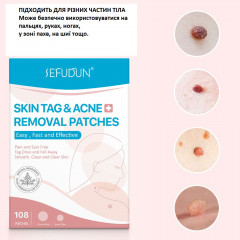 Патчі для видалення бородавок SEFUDUN Skin Tag Removal Patches 108 шт