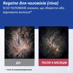 Лечебная пена против выпадения волос для мужчин Regaine For Men Extra Strength 5% набор из 3 флаконов по 73 мл