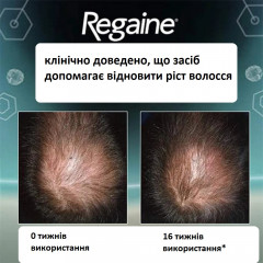 Лікувальна піна проти випадіння волосся для чоловіків Regaine For Men Extra Strength 5% флакон 73 мл курс 1 місяць