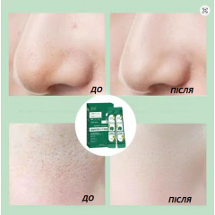 Centella Asiatica Small Bubble Face Mask with Asian Centella Extract, 12 pcs