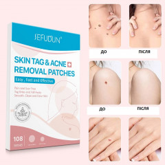 Патчі для видалення бородавок SEFUDUN Skin Tag Removal Patches 108 шт