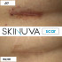 Skinuva Next Generation Scar Cream 30 ml for post-operative and everyday scars