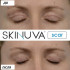 Skinuva Next Generation Scar Cream 30 ml for post-operative and everyday scars