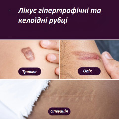 Пластыри для коррекции шрамов Mederma Silicone Small 4 штуки 3,5 х 7,6 см