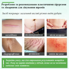 Силіконові пластирі від шрамів і рубців Elaimei Silicone Scar Sheets набір 16 штук 15х4 см бежевий