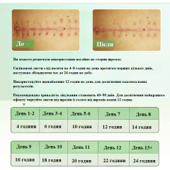 Силіконові пластирі від шрамів і рубців Elaimei Silicone Scar Sheets набір 16 штук 15х4 см бежевий