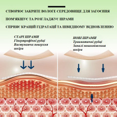 Силіконові пластирі від шрамів і рубців Elaimei Silicone Scar Sheets набір 16 штук 15х4 см бежевий