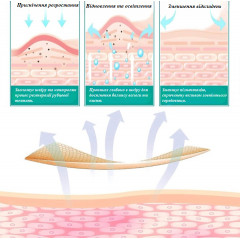 Силіконові пластирі від шрамів і рубців Elaimei Silicone Scar Sheets набір 16 штук 15х4 см бежевий