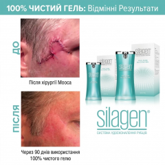 Silicone gel for scar treatment and healing Silagen Scar Refinement System 15 g
