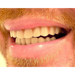 Временные косметические виниры для верхнего зубного ряда Instant Smile Comfort Fit Flex Natural Shade (естественный белый тон)