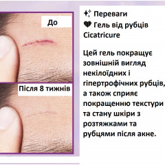 Гель від шрамів для обличчя та тіла Cicatricure туба 28 г