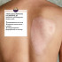 Набір від шрамів і розтяжок олія для тіла Bio-Oil 200 мл і гель Mederma Advanced 20 г