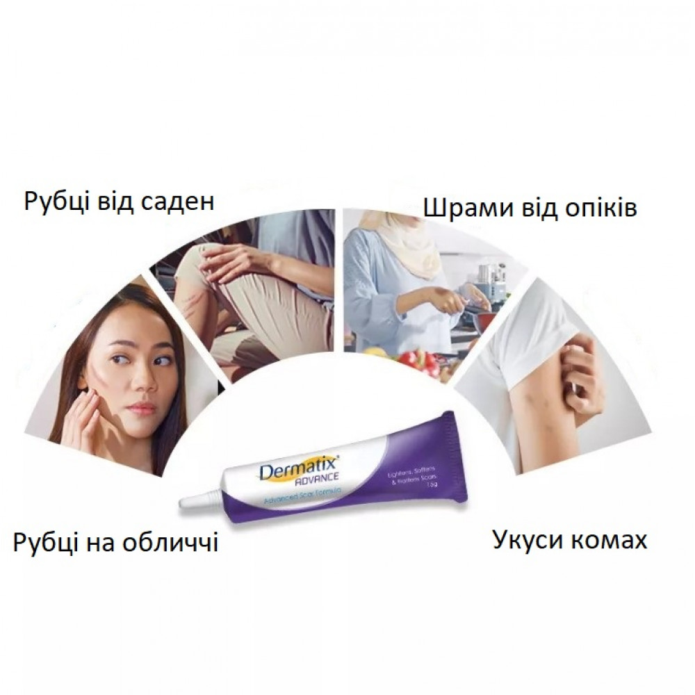 Dermatix Advance silicone gel for scar treatment in 3 months