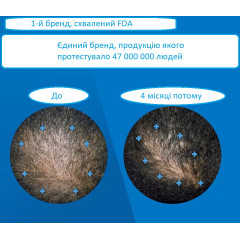 Чоловічий засіб Rogaine Extra Strength 5% для росту волосся з дерма-ролером